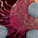 El tratamiento del cáncer en Ayurveda