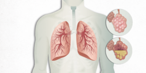 neumonia ayurveda