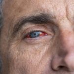 Cuida tus ojos irritados con Ayurveda