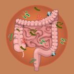 Causas del SIBO y Ayurveda